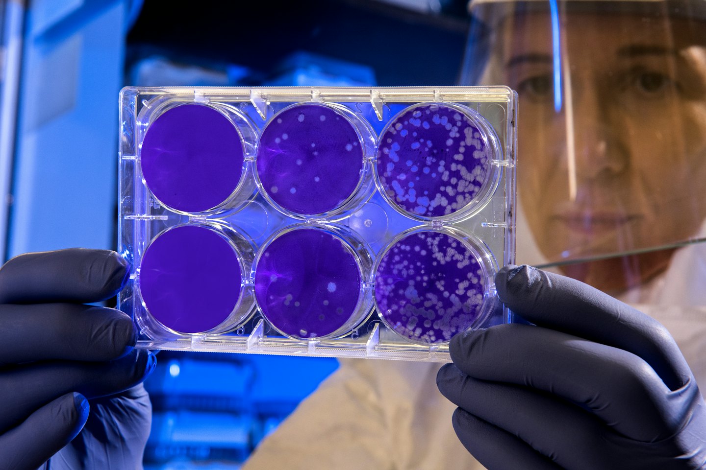 Scientist in lab coat examines multi-well plate with bacterial growth.